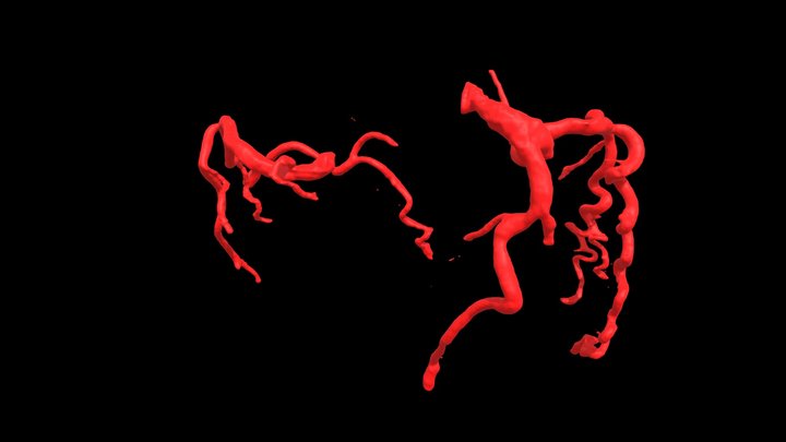 Heart0064 Coronary Arteries 3D Model