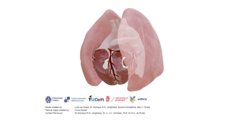 Transposition of the great arteries – Modello 3D gratuito STL