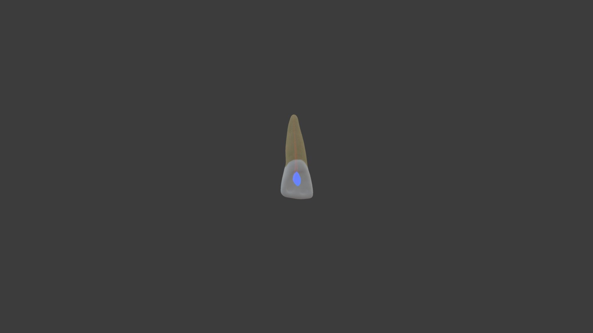 maxillary central Acess Ovoid