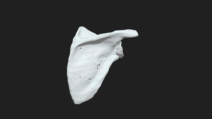 Right Scapula Reconstruction 3D Model