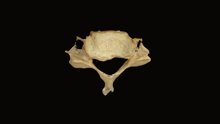 C6 Vertebra 3D Model