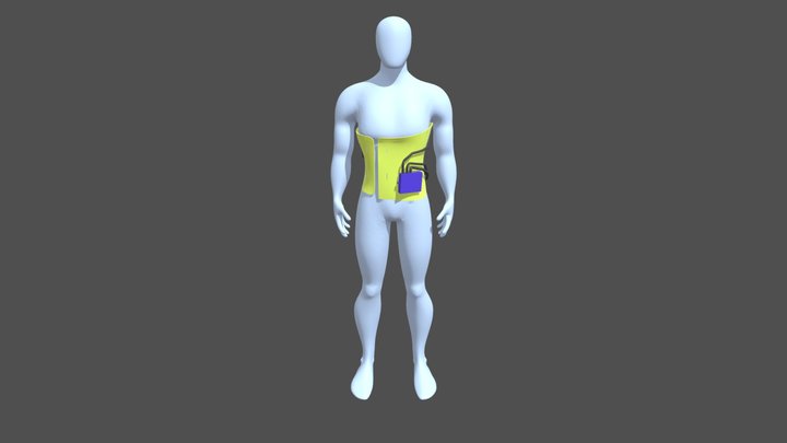 Scoliosis Brace 3D Model