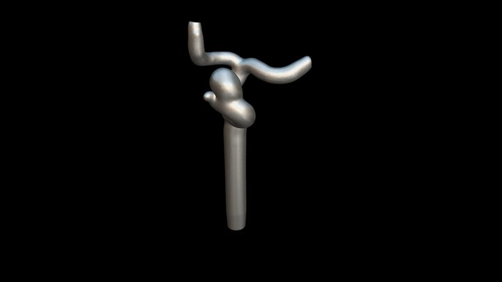 Aneurisma segmento oftálmico de ACI derecha 3D Model