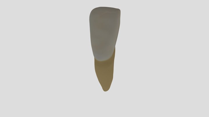 Mandibular Central Incisor (Right)