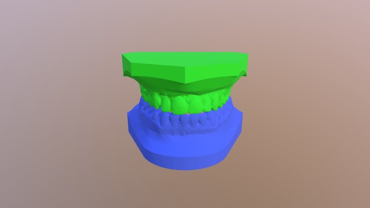 Laelsonoclusion 3D Model