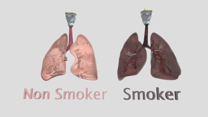 lung of smokers and non-smokers 3D Model