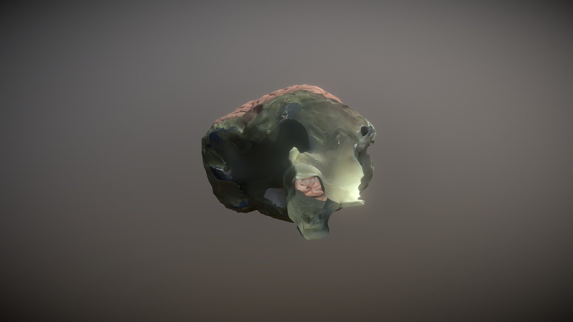 Full Brain A1