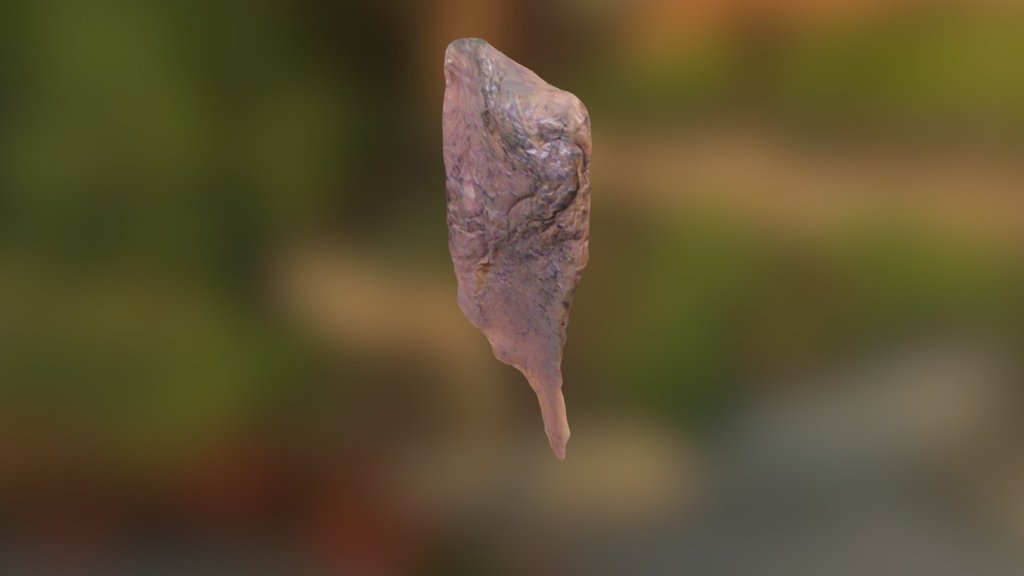 normal lung