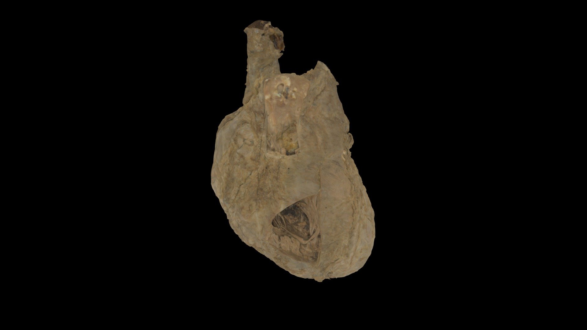 Plastinated Human Cadaver Heart Download Free 3D model by
