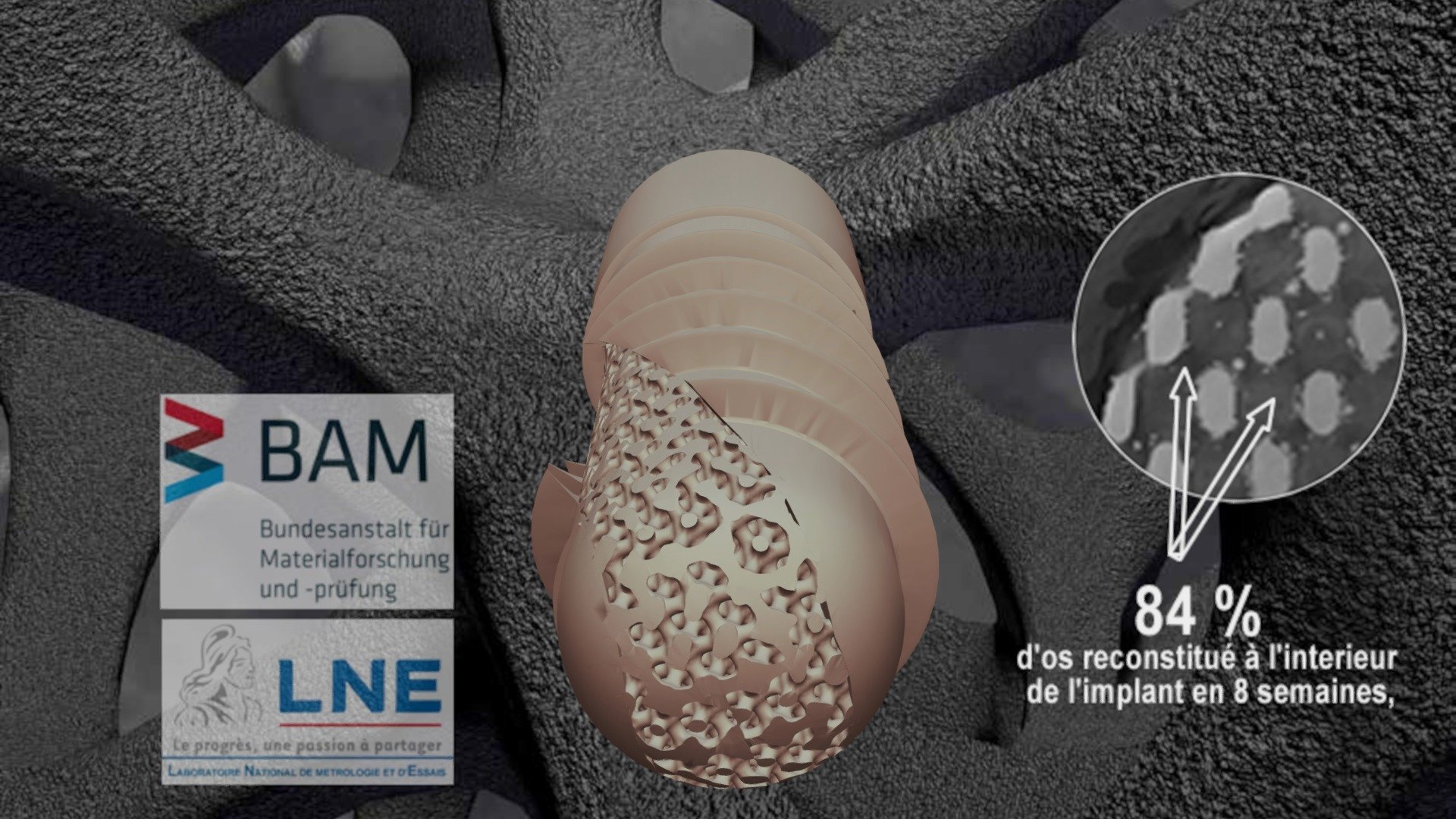 DNA Implant Helico-interne_400