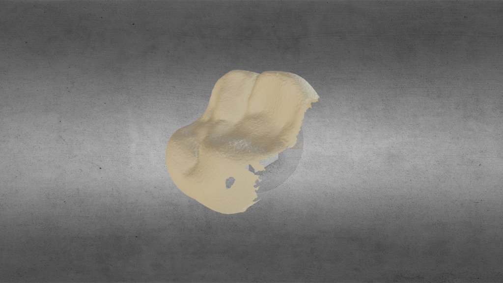 Merged Tooth