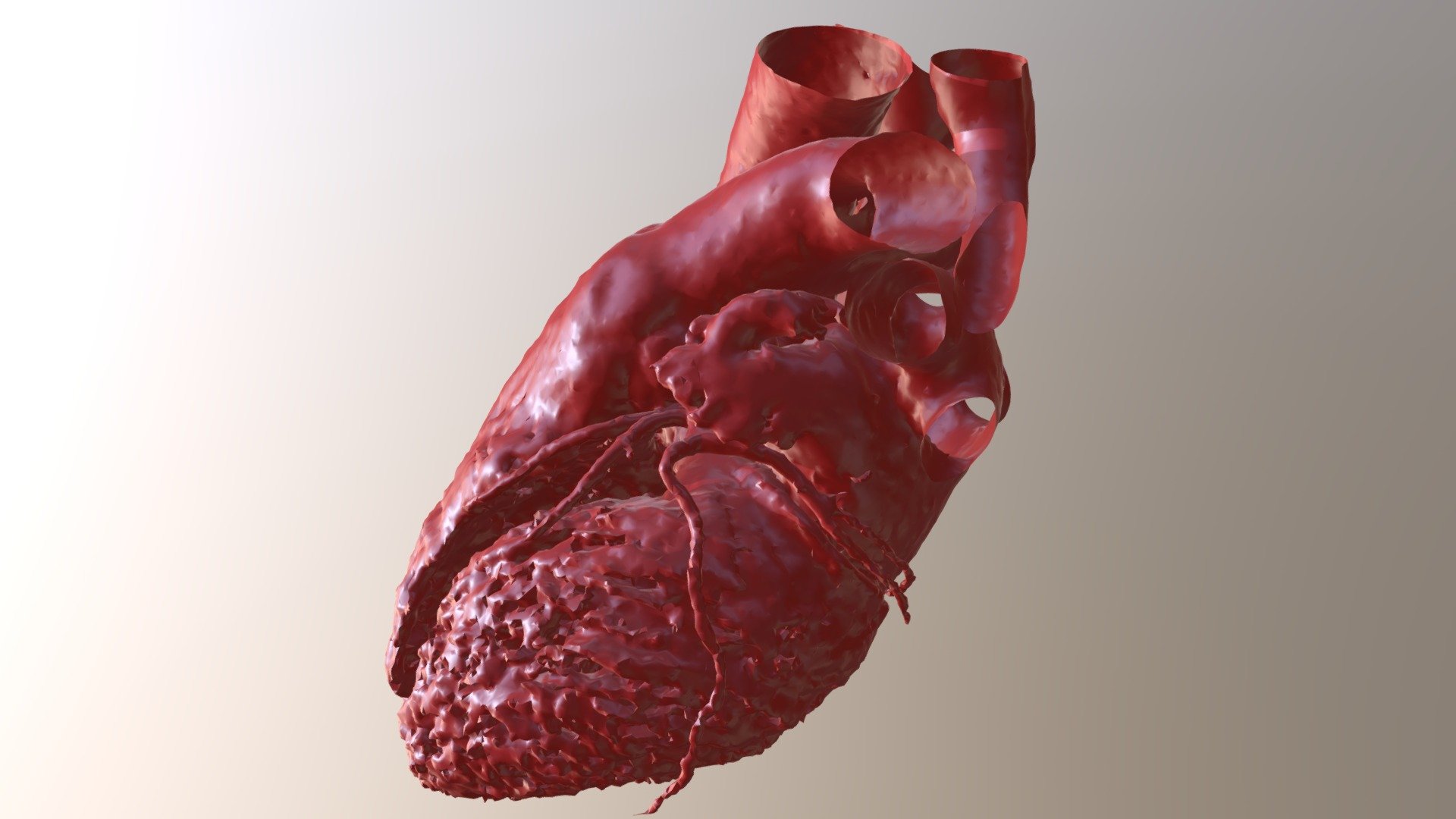 Cardiac Computed Tomography Heart Model