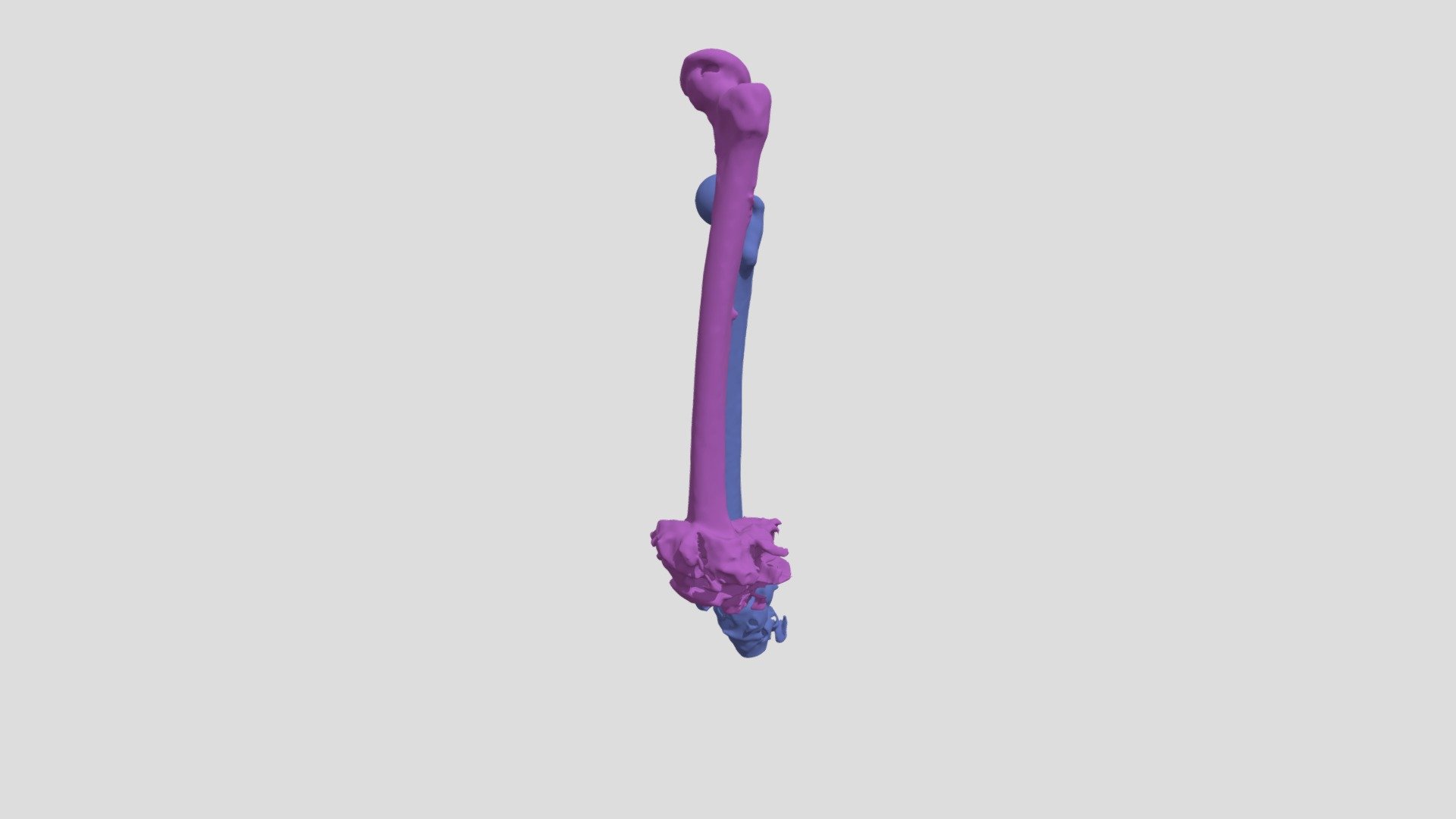 Femurs
