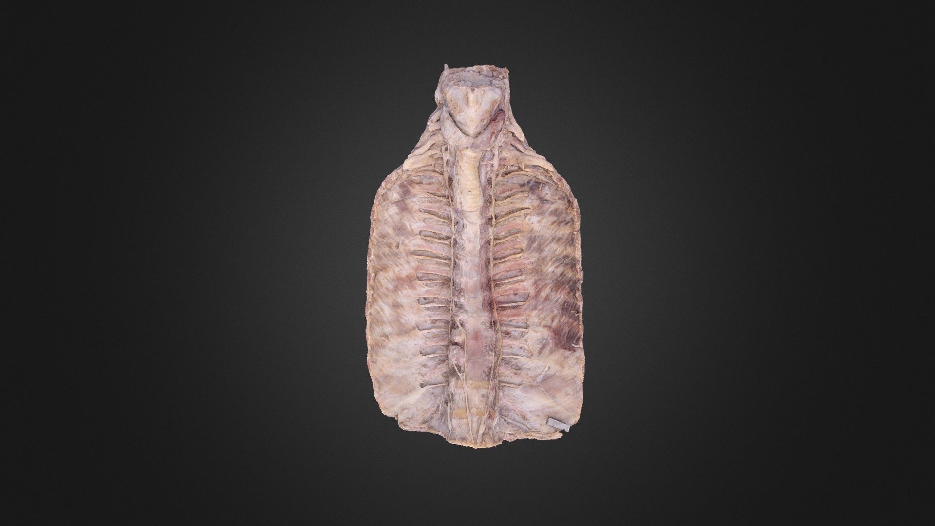Posterior Thoracic Wall — Sketchfab embed 3D viewer