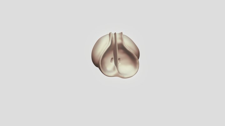Transposition of Great Vessels- Embryonic Heart 3D Model
