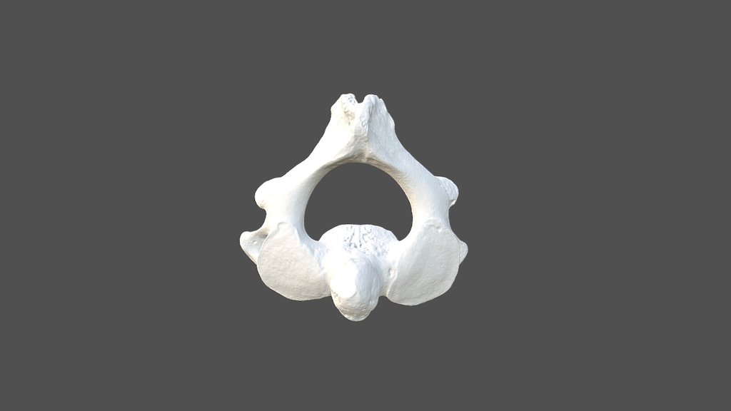 Cervical Vertebra 2