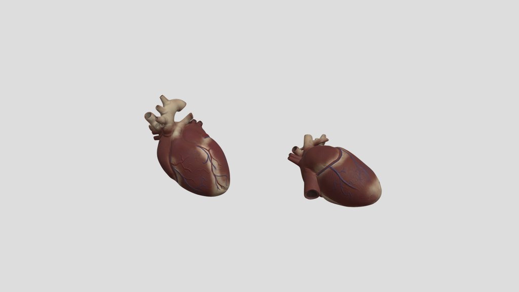 Exposed Heart