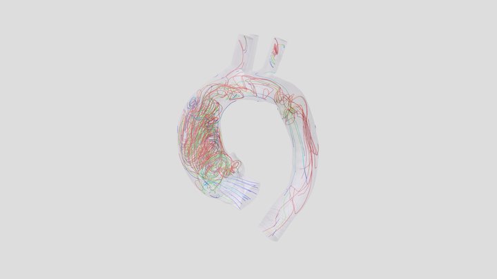 BAV(aorta+final_step) 3D Model