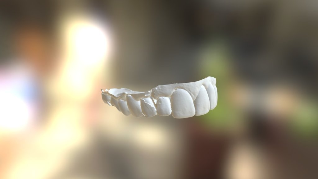 Ken Upper Jaw