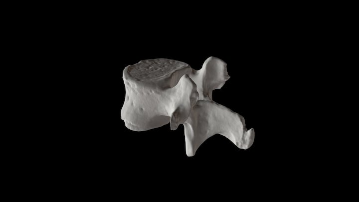 Human Lumbar Vertebra – Free 3D Model STL