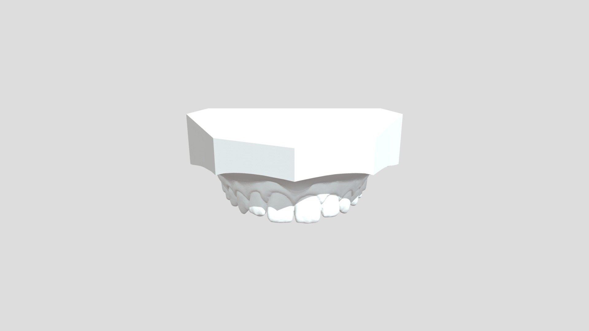Any Conv Com Maxillary Model