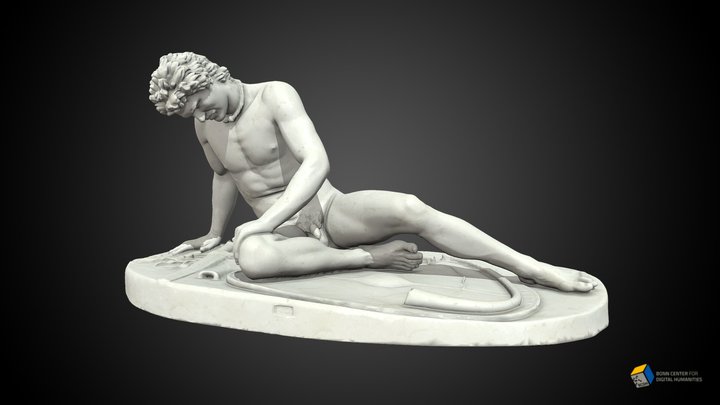 Dying Gaul