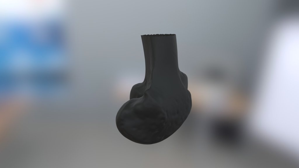 Distal Femur Warm
