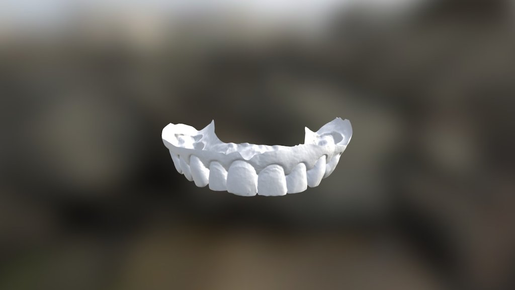 Chantel Upper Jaw