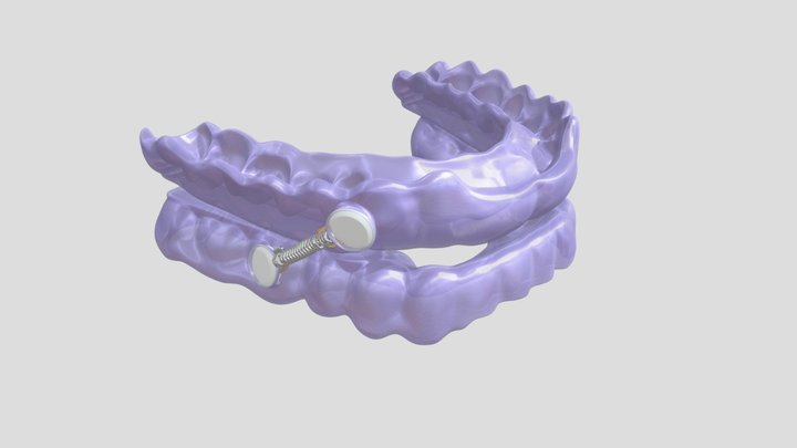 Bfit 2022 Spring Appliance 3D Model