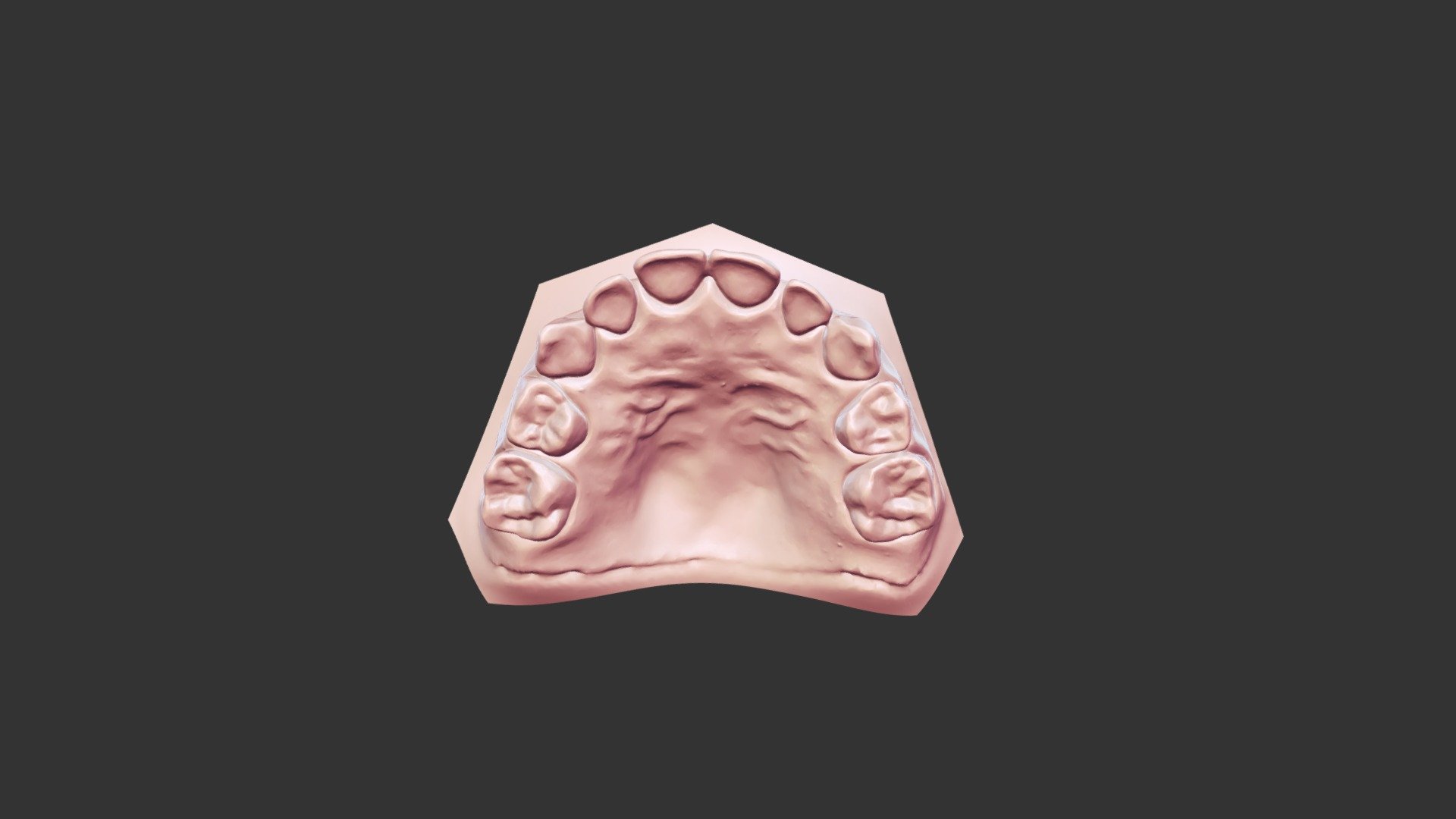 Maxillary Primary Typodont - 3D model by Virtual Dental Library ...