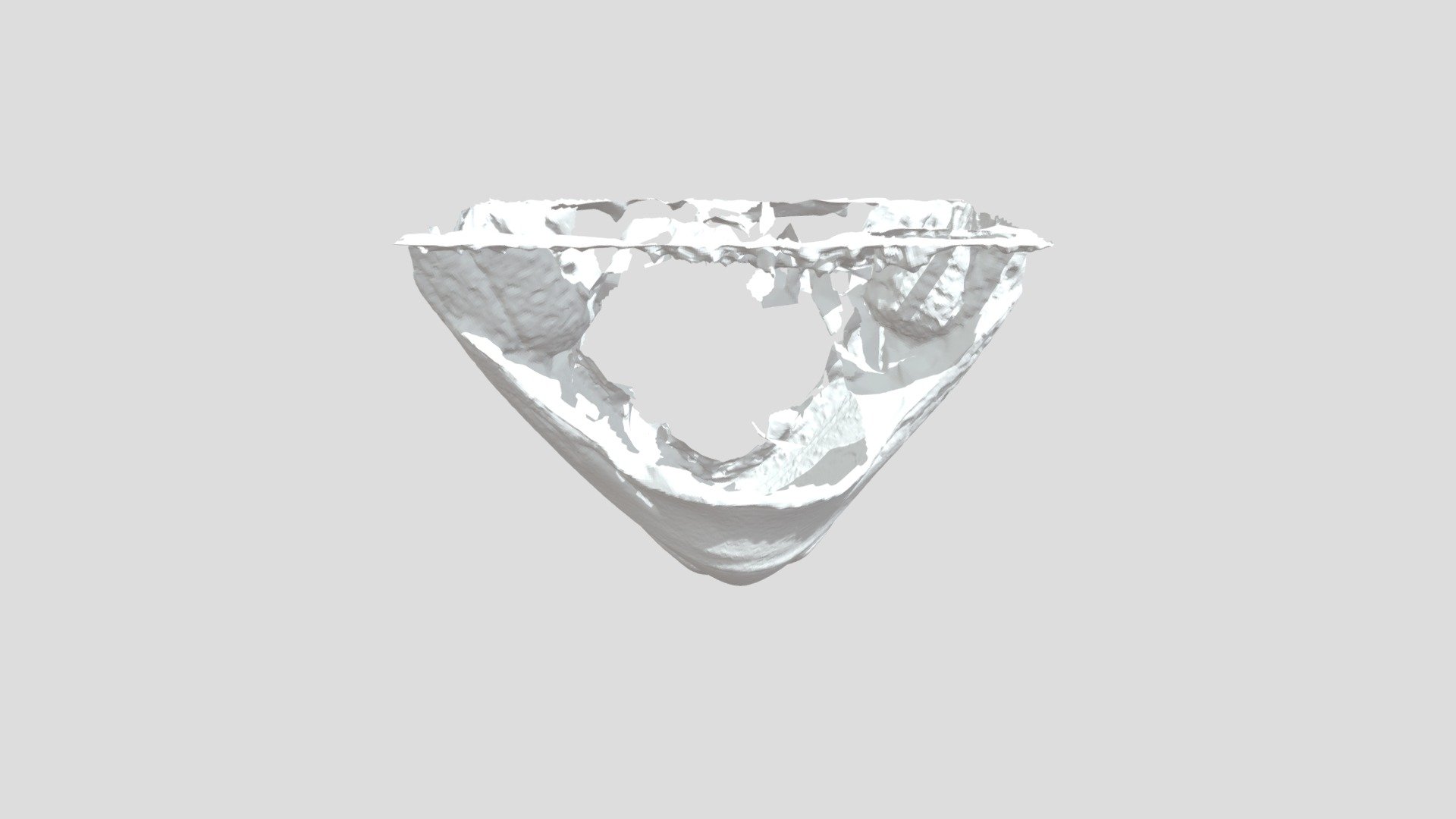 NOX Helmet Chin for GoPro Mount