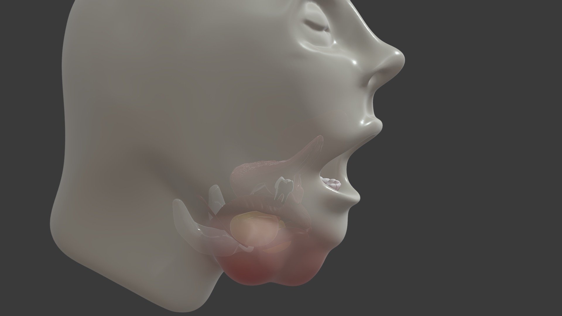 Stage 7 - Mandibular Molar Infection Pathway 4 - 3D model by University ...