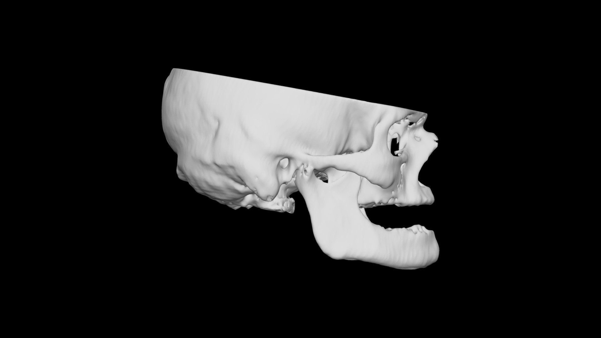 Skull Male 45yo