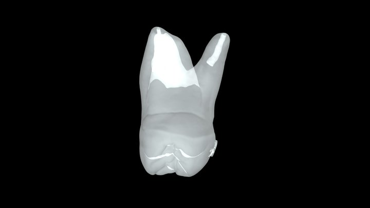 Tooth 3 Calcified 3D Model