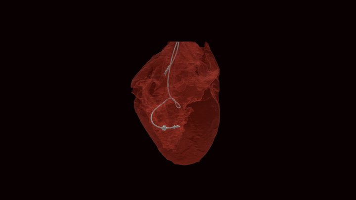Pacemaker 3D models - Sketchfab