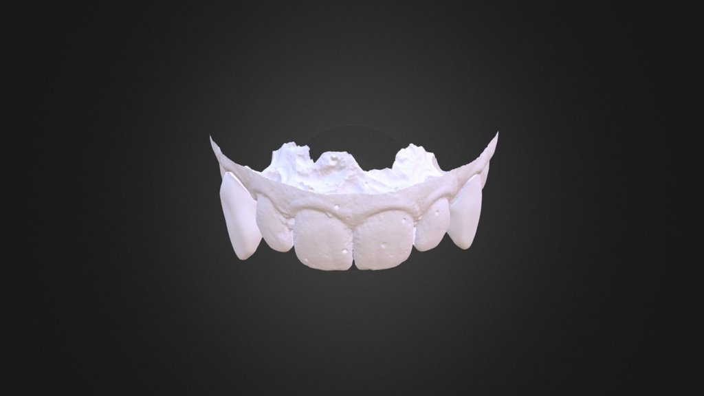 Canines - 3D model by bdprotheses [f29a779] - Sketchfab