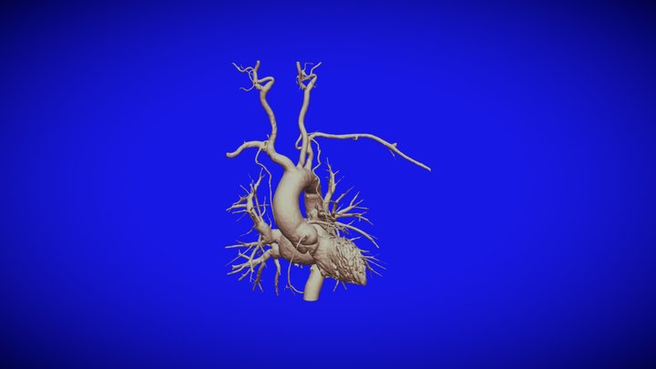 LEFT HEART.AORTA.LEFT VENTRICLE.LEFT ATRIUM. – Modello 3D gratuito STL