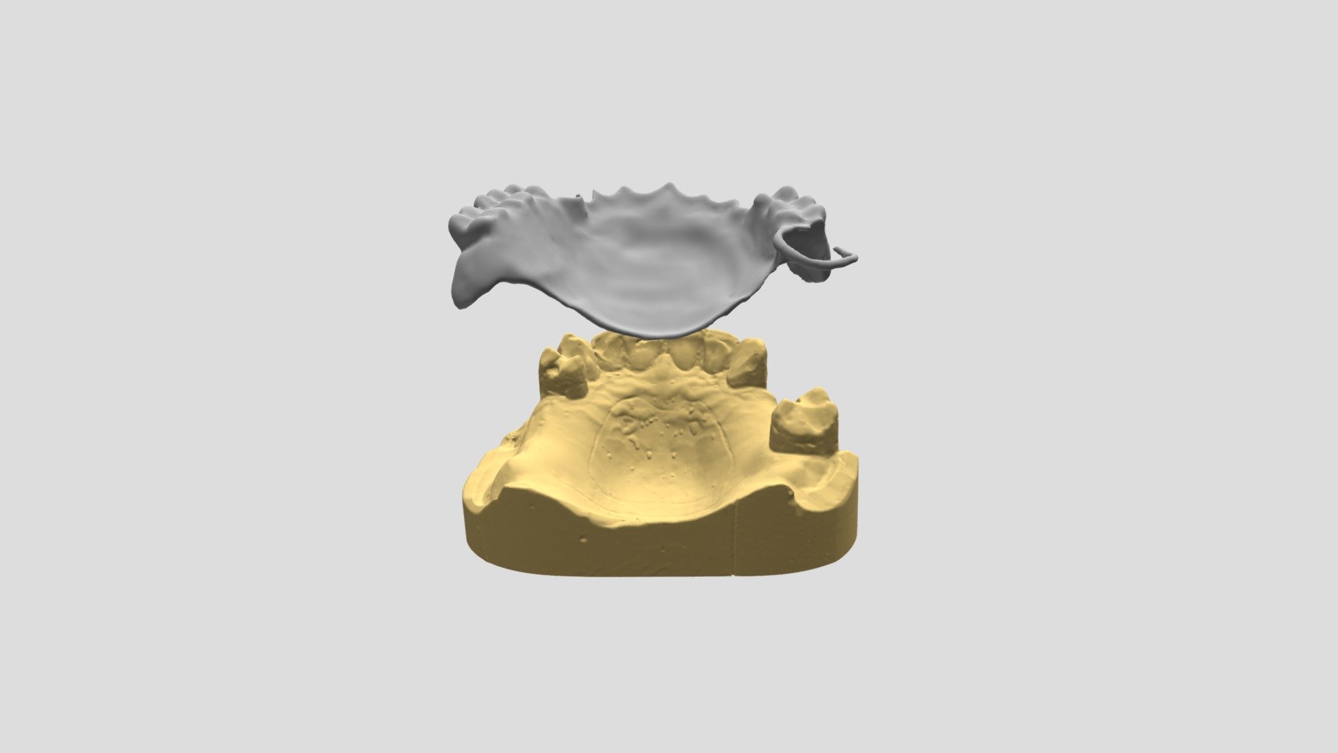 Palatal Plate