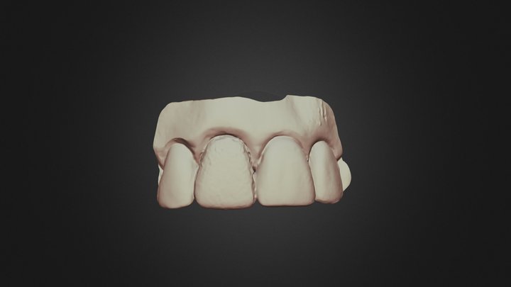 Tooth8 2,group12,scanner4 Upper Jaw 3D Model