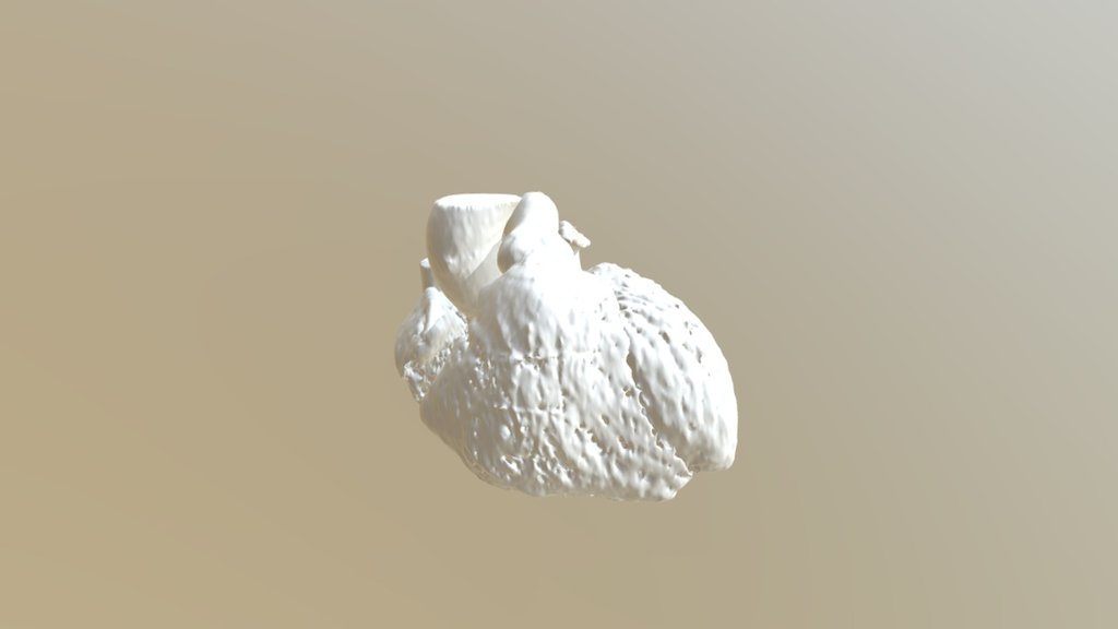Model 4