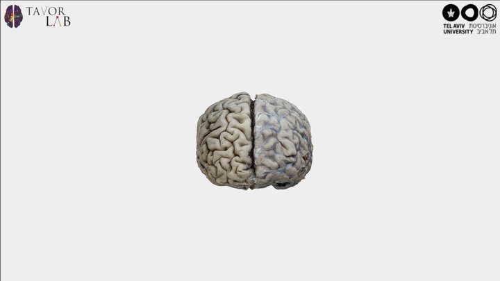 Whole brain with gross anatomy annotations 3D Model