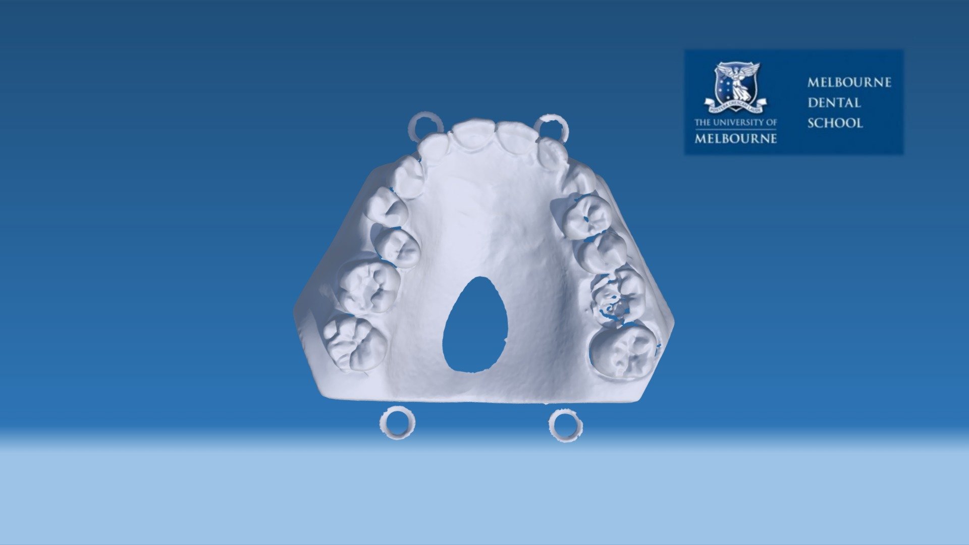 Dental Impression Model 6 3d Model By Melbourne Dental School