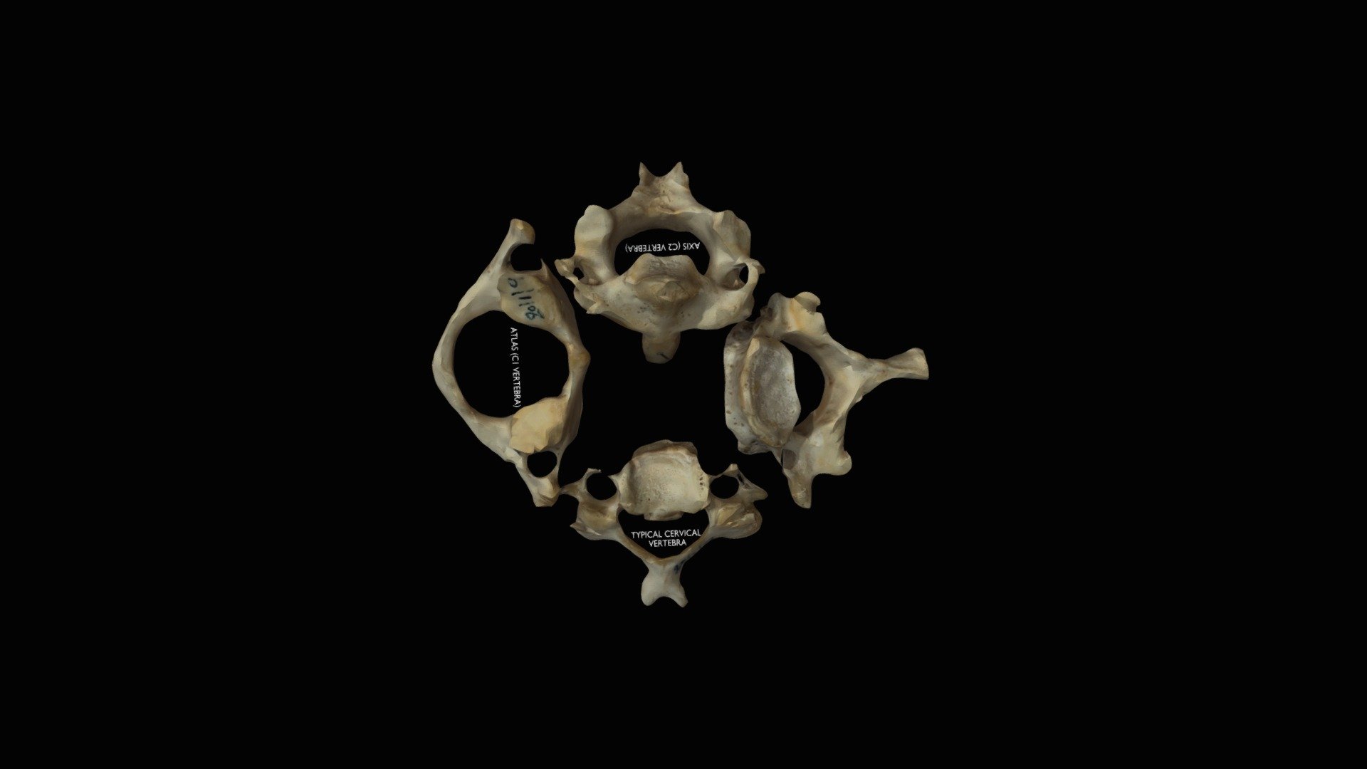 Inferior view of cervical vertebra