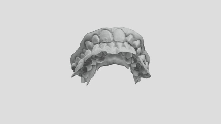 79985604_shell_lockedocclusion_ul 3D Model