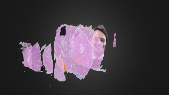 prostate gamem.zip 3D Model