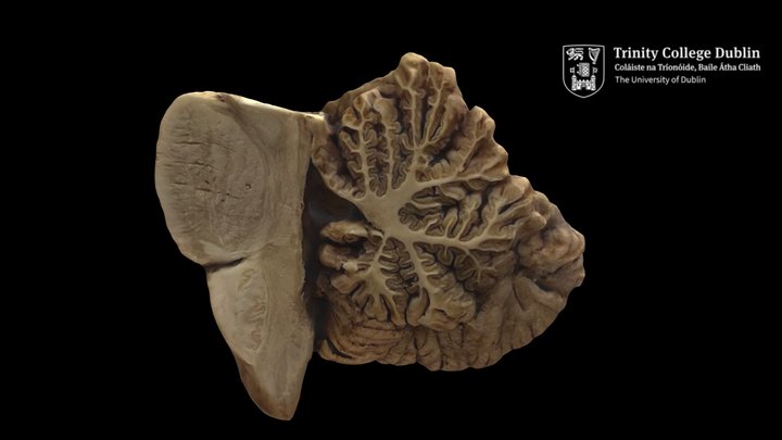 Mid-Sagittal Brainstem and Cerebellum 3D Model