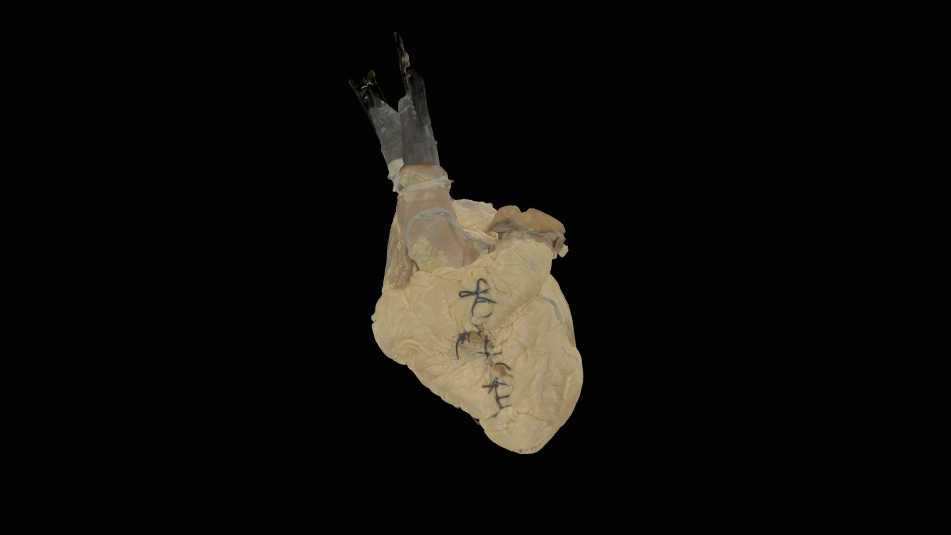 Perfusion Fixed Human Heart #0176