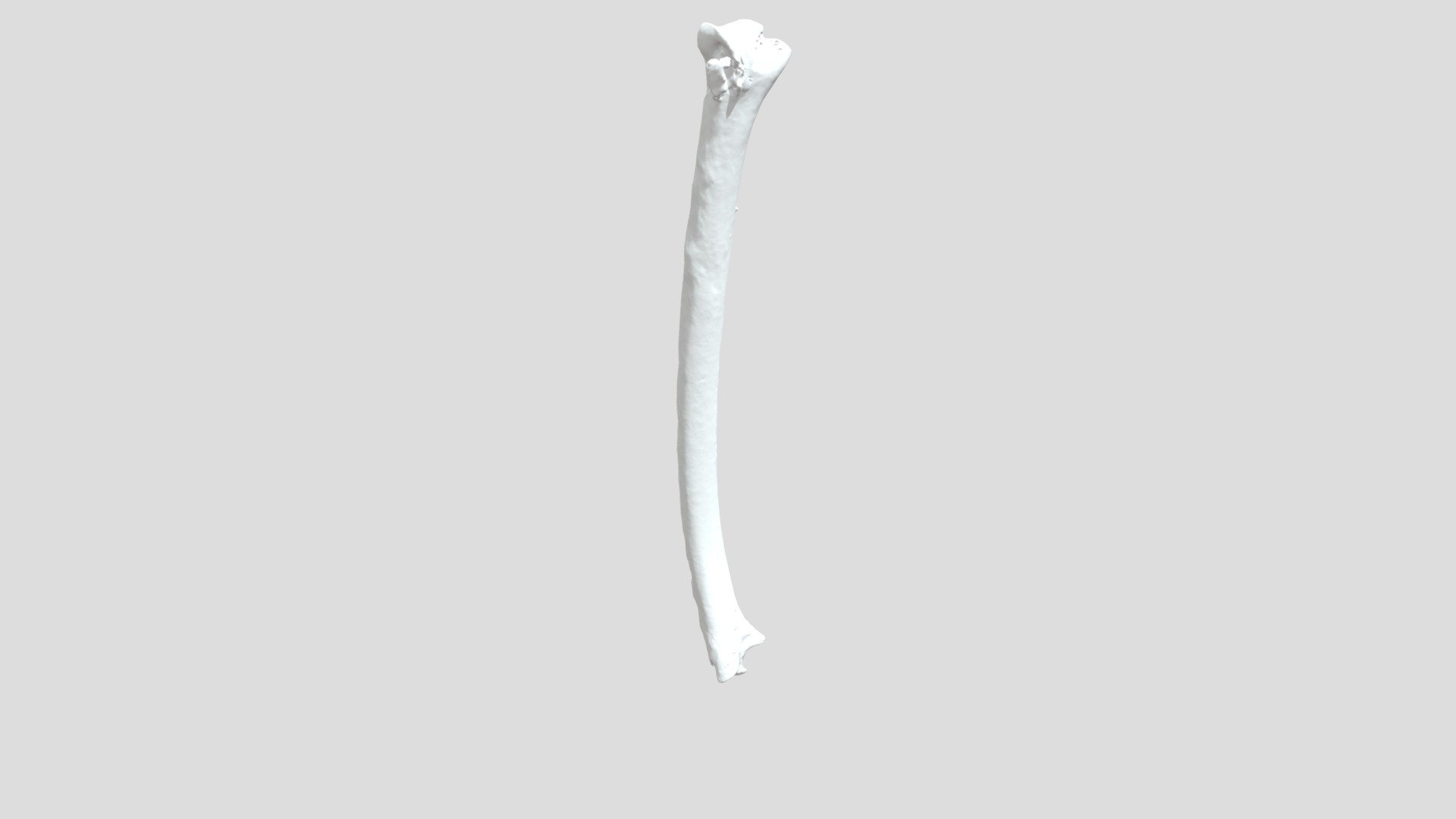 W7381 L Ulna