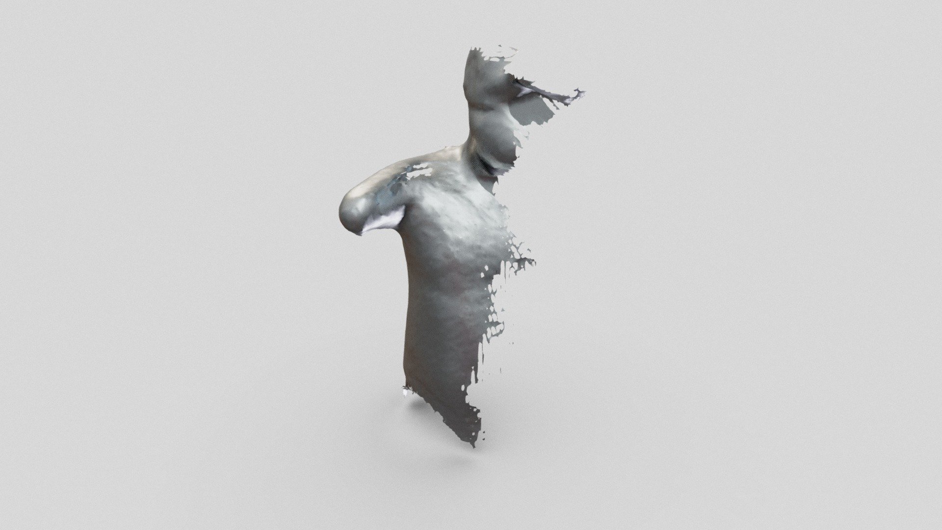 Amputee Scan — Sketchfab embed 3D viewer