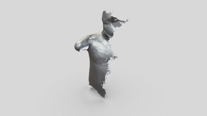 Amputee Scan 3D Model